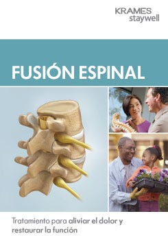 Spinal Fusion (Spanish)