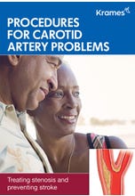 Procedures for Carotid Artery Problems
