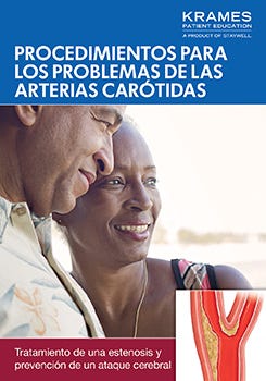 Procedures for Carotid Artery Problems (Spanish)