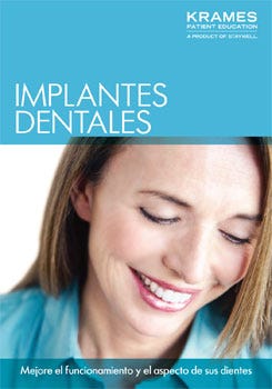 Understanding Dental Implants (Spanish)