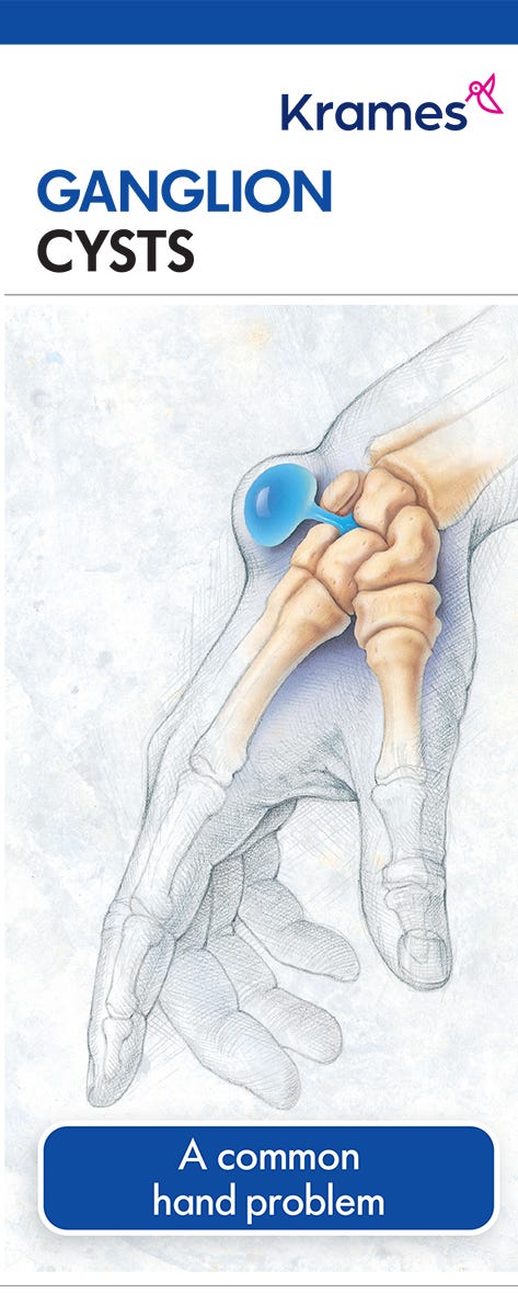 Ganglion Cysts