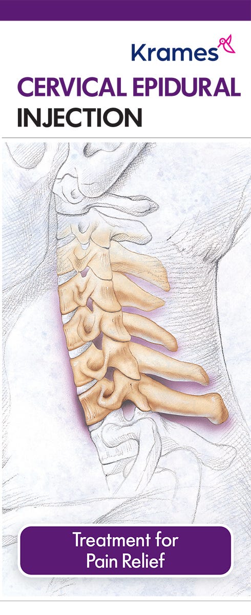 Cervical Epidural Injection