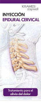 Cervical Epidural Injection (Spanish)