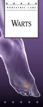 Warts
