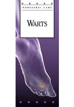 Warts